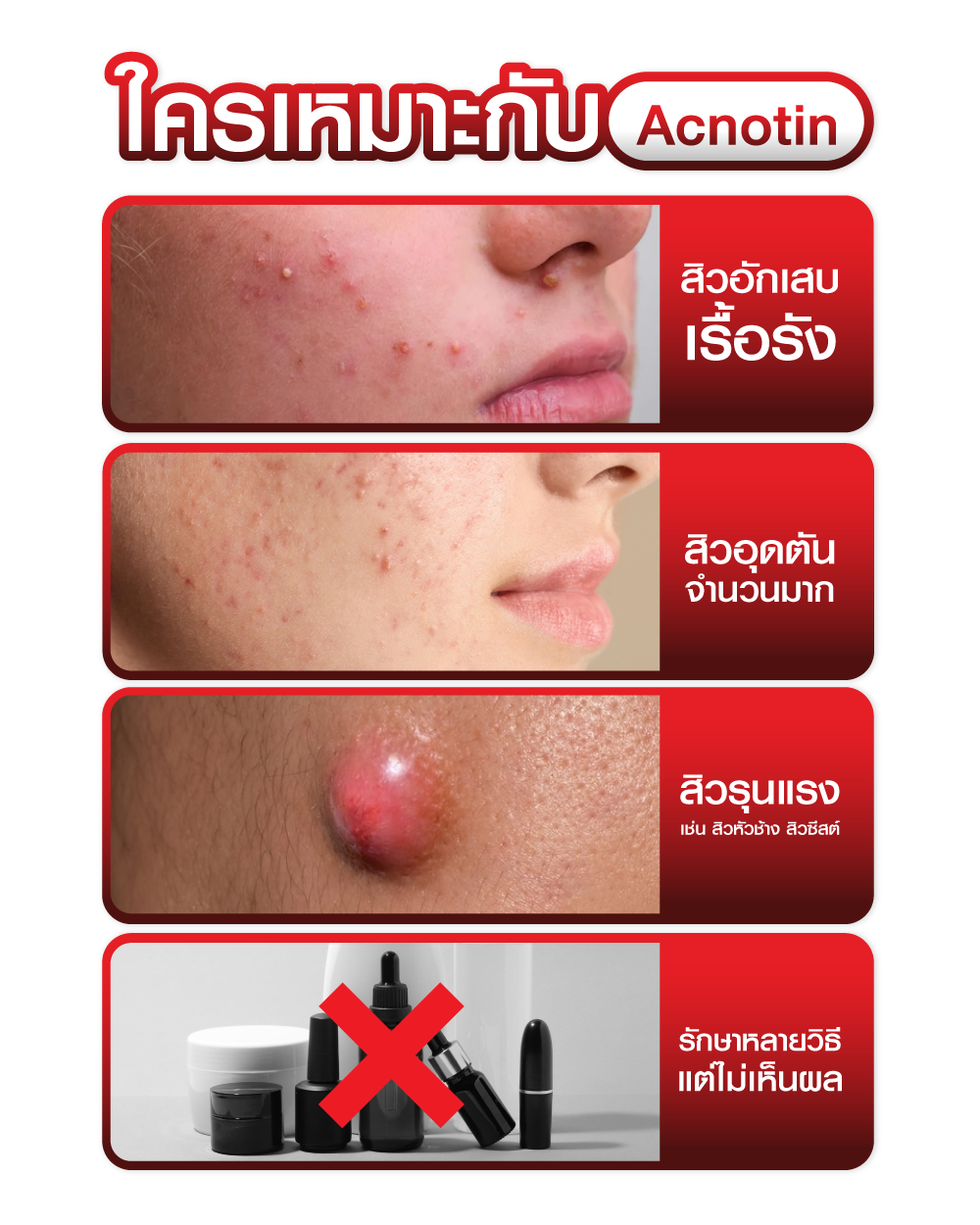 Acnotin laliza19 (2)