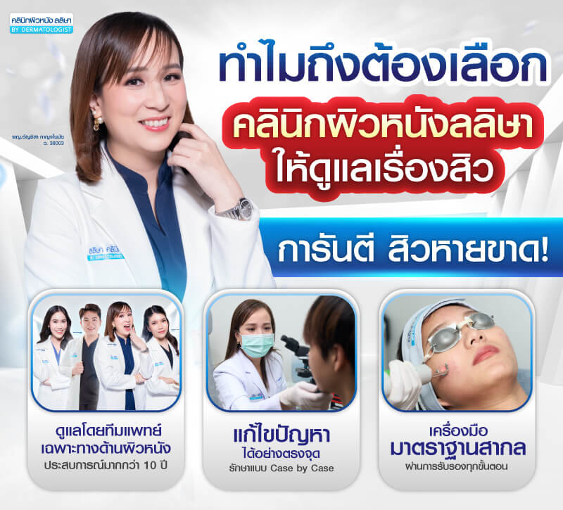ทำไมถึงต้องรักษาสิวกับคลินิกลลิษาคลินิก
