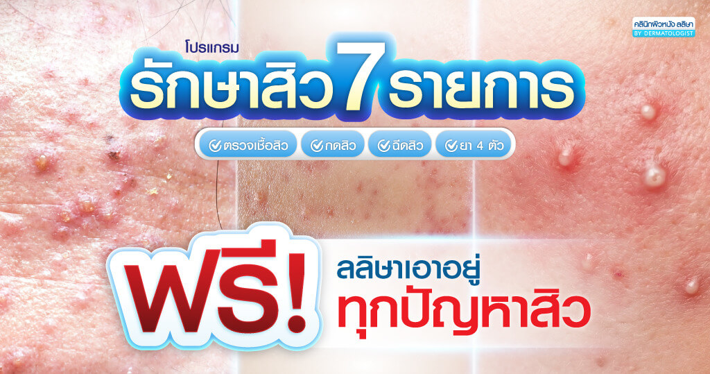 โปรแกรมรักษาสิว 7 รายการ